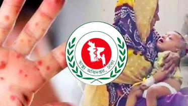 ২৪ ঘন্টায় হাম উপসর্গে তিনজনের মৃত্যু